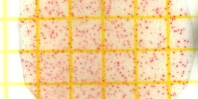 Multiresistente Keime in Gewässern - was Kanusportler beachten sollten